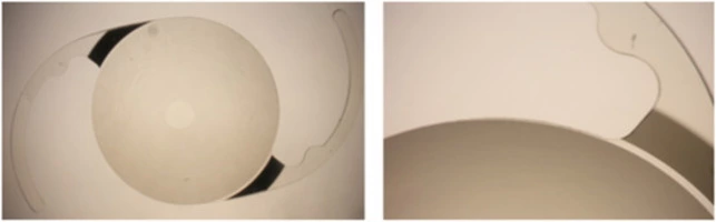 New IOL material - xPIB - Article thumbnail