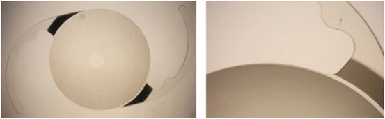 New IOL material - xPIB - Featured image