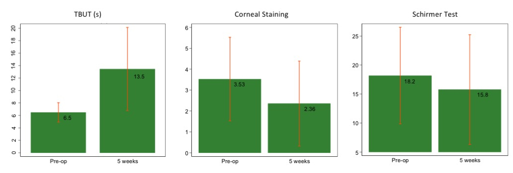 Dry eye drops - Featured image