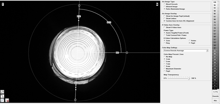 Determining the axis position of a toric IOL