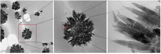 Supplementary IOL calcification - Featured image