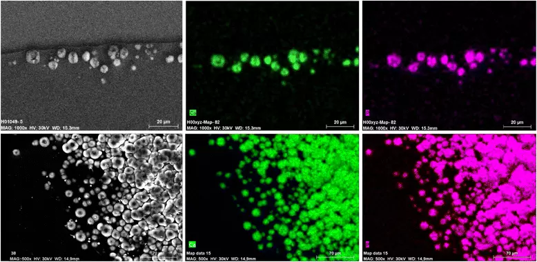 Hydrophilic acrylic IOLs and Lamellar keratoplasty - Featured image