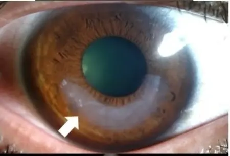 CAIRS - Featured image