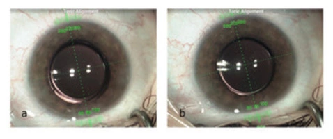 Reversible Trifocality - Article thumbnail