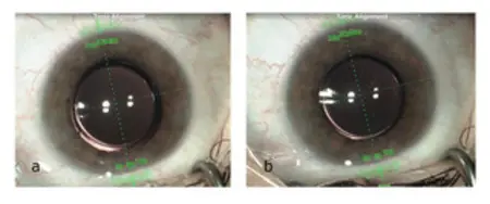 Reversible Trifocality - Featured image