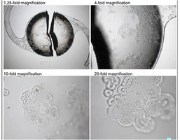 A rare case of Calcification - Article thumbnail