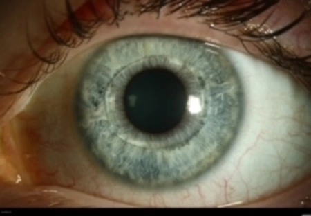 Pupil dynamics - Featured image