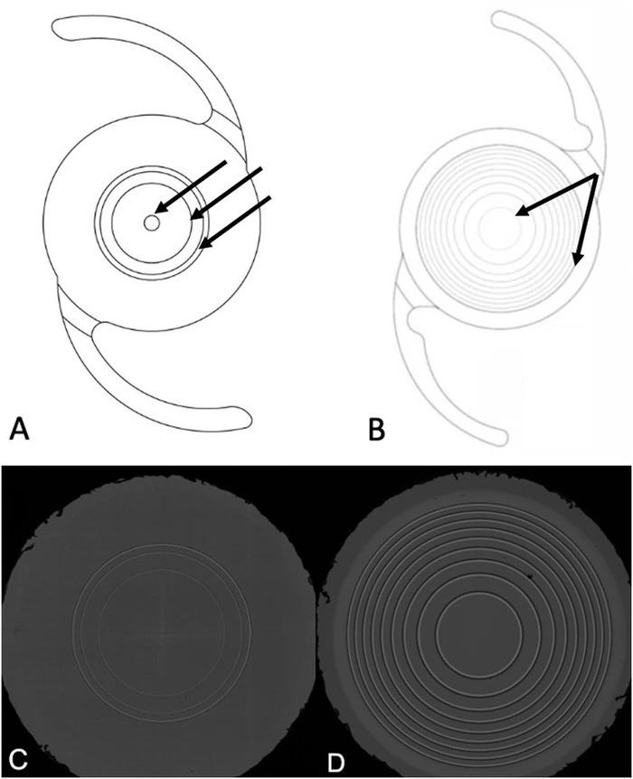 Figure 1 (A) Shows drawings of the xact Mono-EDoF IOL and (B) of the Symfony IOL. The arrows indicate the diffractive rings of each IOL model. (C) shows a surface image of the xact Mono-EDoF and (D) a surface image of the Symfony IOL. Figure 1 (A) Shows drawings of the xact Mono-EDoF IOL and (B) of the Symfony IOL. The arrows indicate the diffractive rings of each IOL model. (C) shows a surface image of the xact Mono-EDoF and (D) a surface image of the Symfony IOL.
