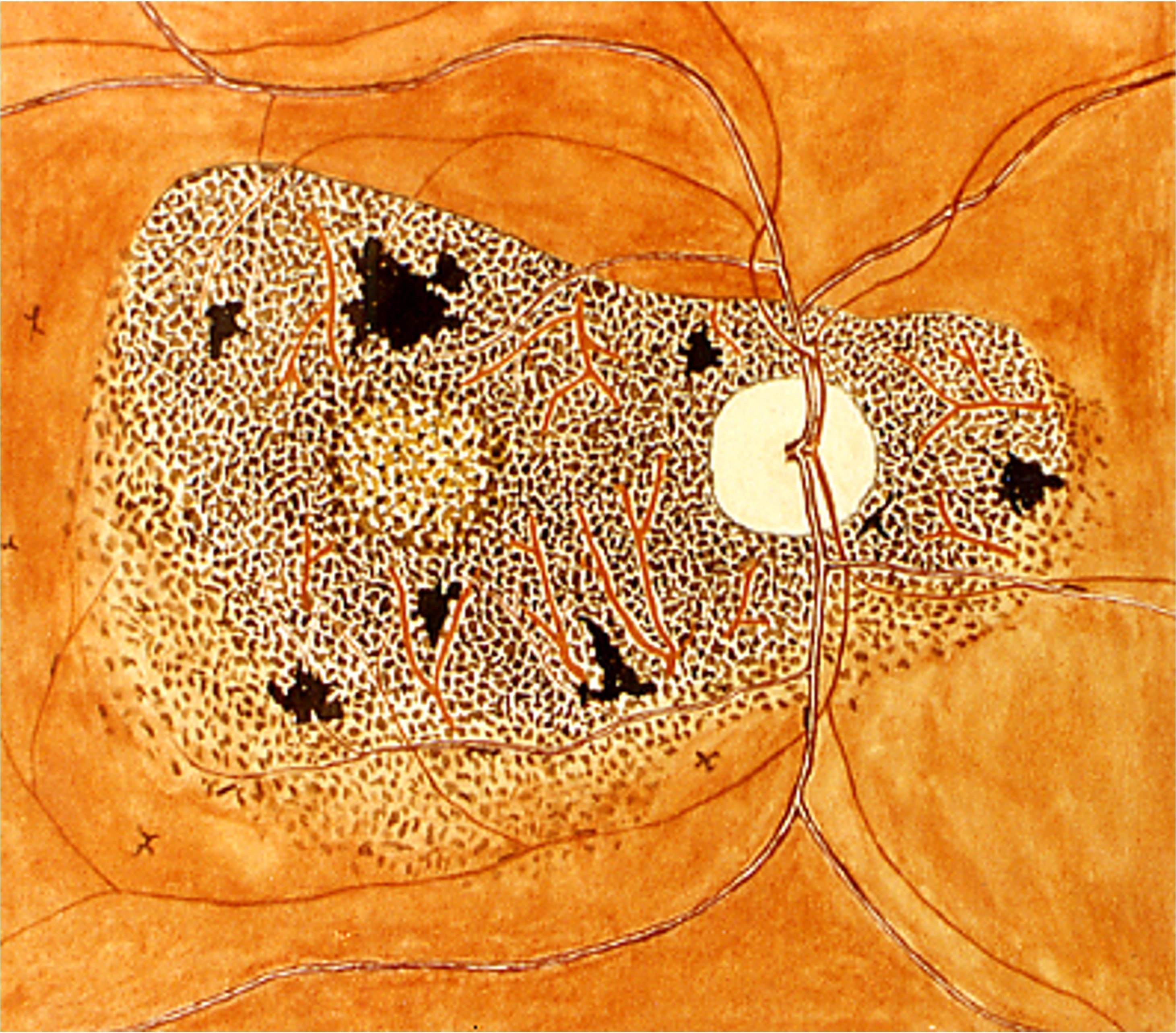 A Novice in Tropical Ophthalmology - Featured image